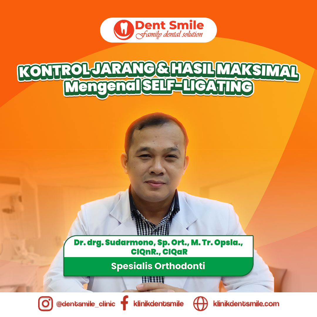 Kontrol Jarang, Hasil Maksimal: Mengenal Behel Self Ligating bersama Dr. drg. Sudarmono Sp. Ort, M.Tr. Opsla., CIQnR., CIQaR